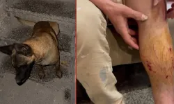 Adıyaman’da Sahipli Köpek Saldırısı: Yolda Yürüyen Adam Yaralandı!