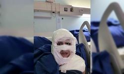 Kadıköy’de dehşet anlarının görüntüsü ortaya çıktı... Genç kadının yüzünü böyle yaktı