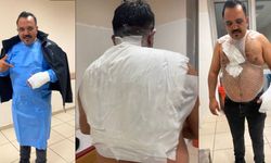 Meşhur tostçu, soğuk havada şov yapmak isterken kendini yaktı