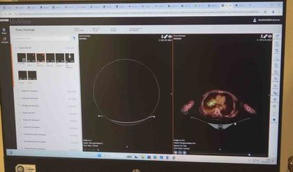 Beslenme biçimi ve yaşam tarzı kanser hastalığını tetikliyor