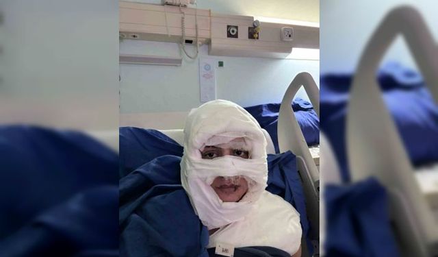 Kadıköy’de dehşet anlarının görüntüsü ortaya çıktı... Genç kadının yüzünü böyle yaktı