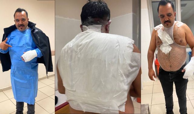 Meşhur tostçu, soğuk havada şov yapmak isterken kendini yaktı